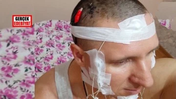 Rüyalarını kontrol etmek için matkapla kafasını deldi